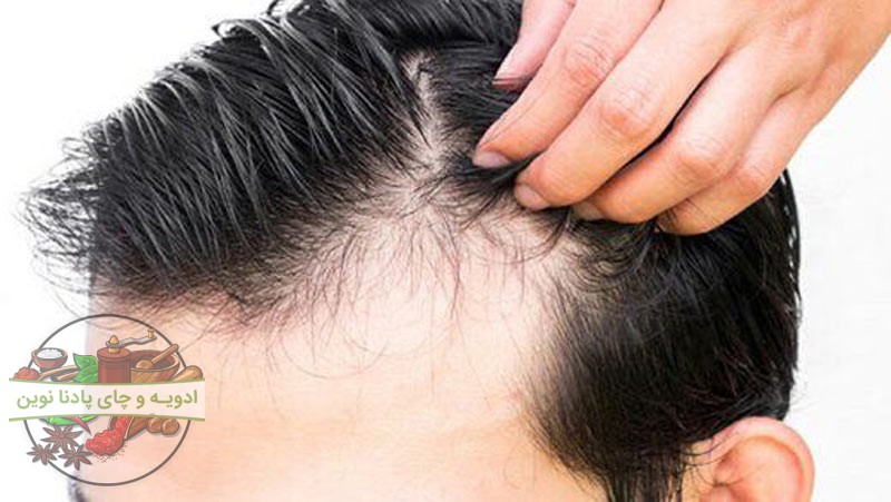 جلوگیری از ریزش مو، خواص میخک برای سلامتی و زیبایی